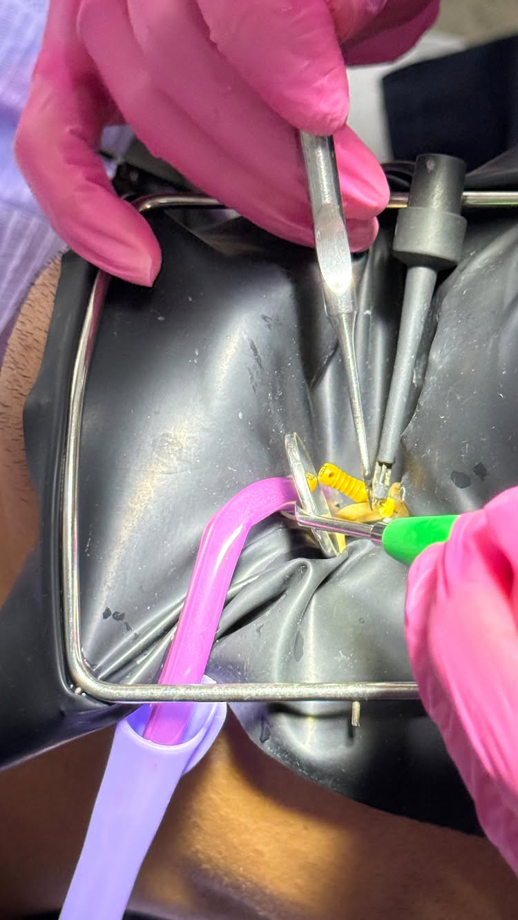 Профессиональная чистка