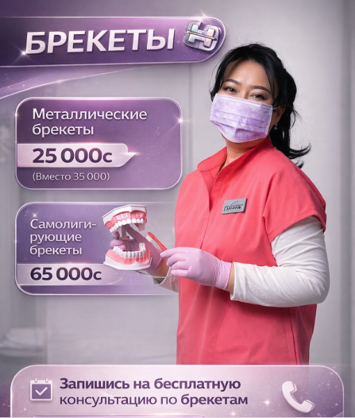 Брекет-системы