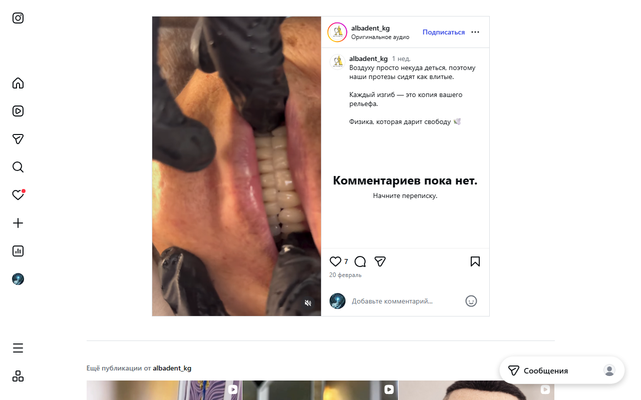 Имплантация зубов в Альба Дент