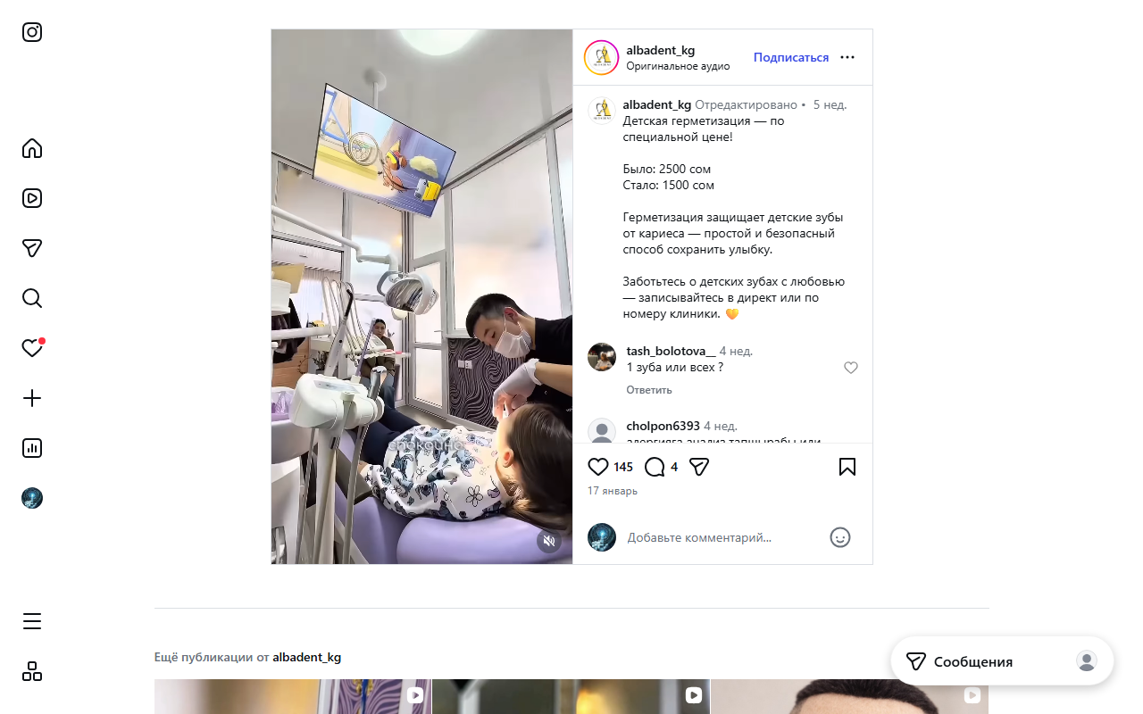 Герметизация детских зубов